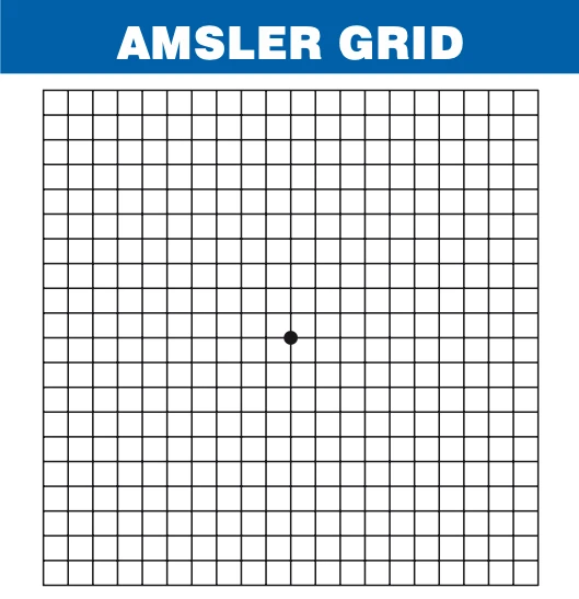 You can monitor your vision at home using an Amsler grid.